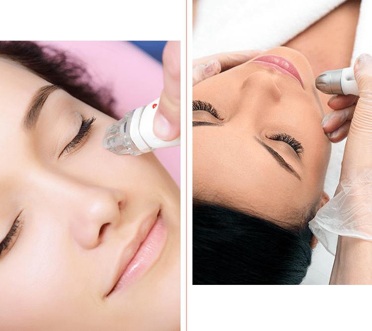 Fotoringiovanimento viso